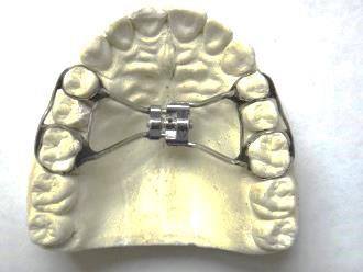 Expanders