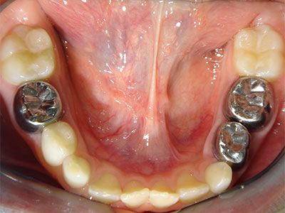 baby crowns