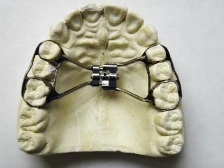 expander