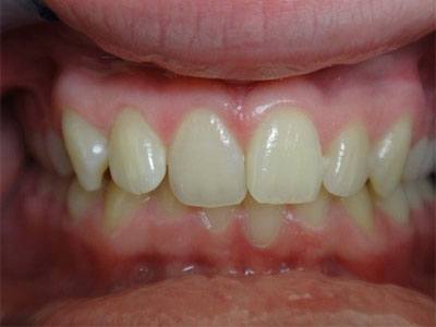 Teeth