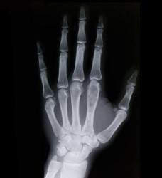 x-ray