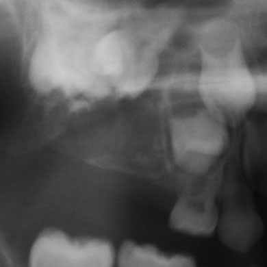 xrays