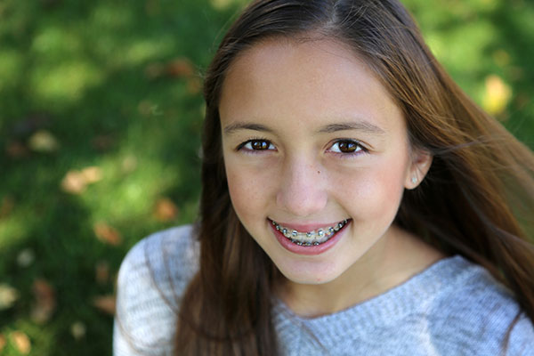 Braces