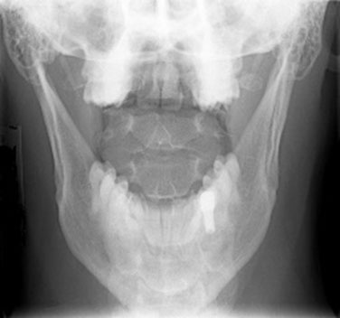 Tooth Questions