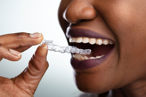 Spring Retainer