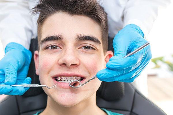 Spring Retainer