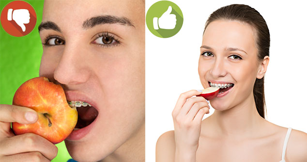 Eating with Braces