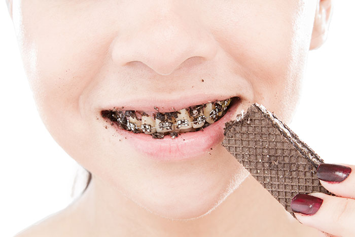 Eating with Braces