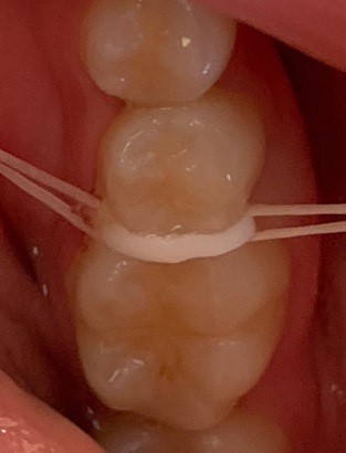 Expander