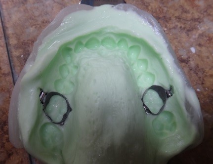 Expander