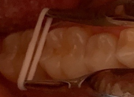 Expander
