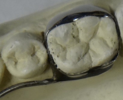 Expander