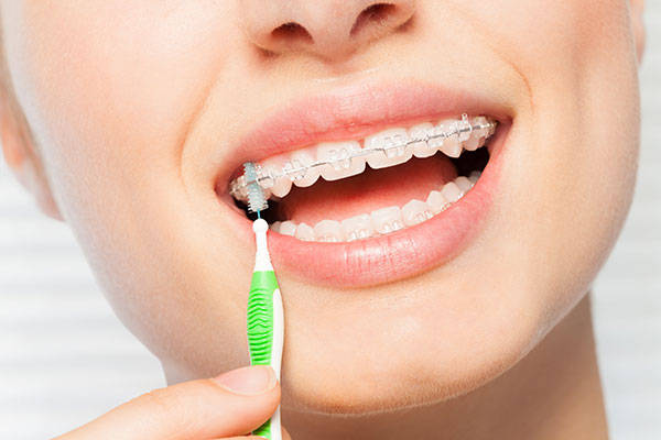 Oral Hygiene