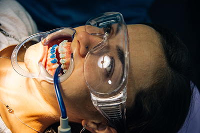 Invisalign